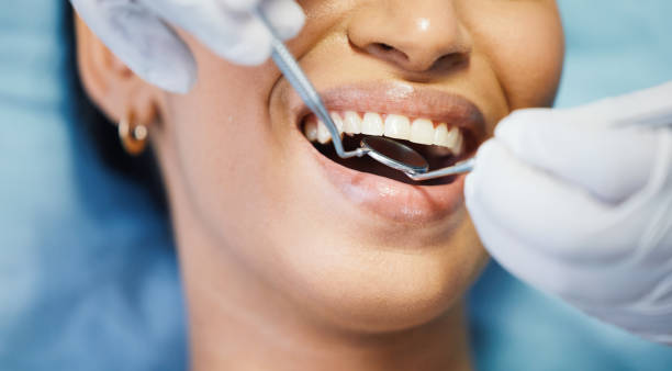 Best Emergency Dental Care for Broken or Chipped Teeth in Atmore, AL
